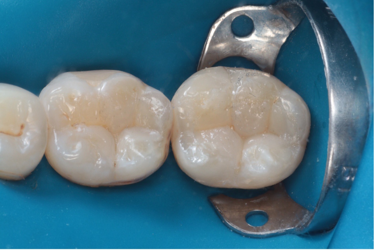 Figura 9 – morfologia oclusal