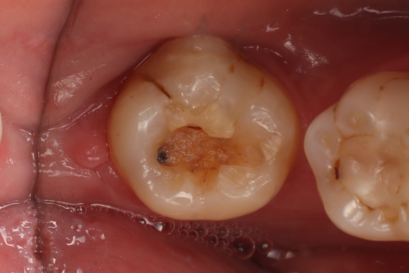 Figura 1 – Fotografia inicial