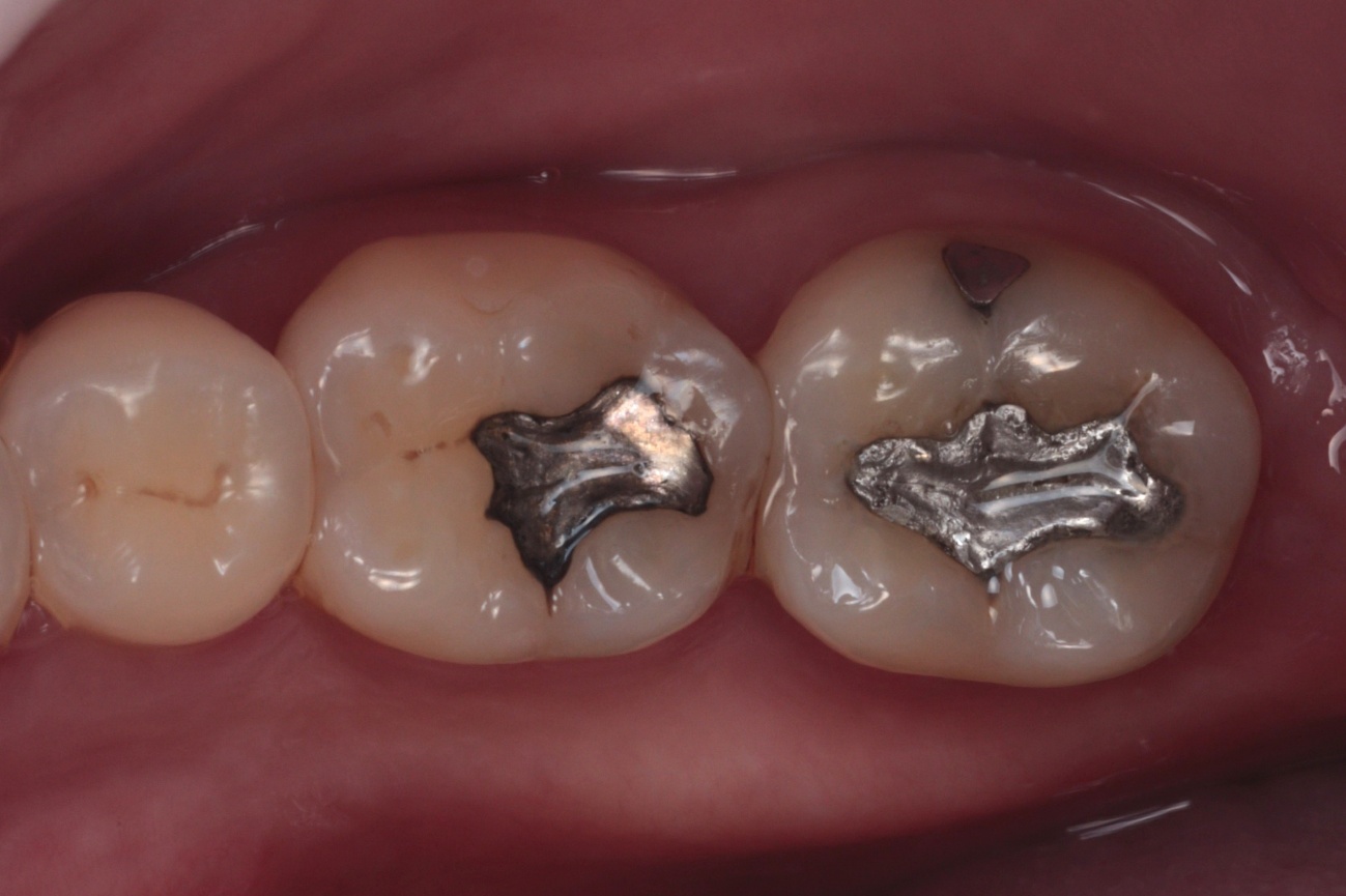 Figura 1 – Fotografia inicial