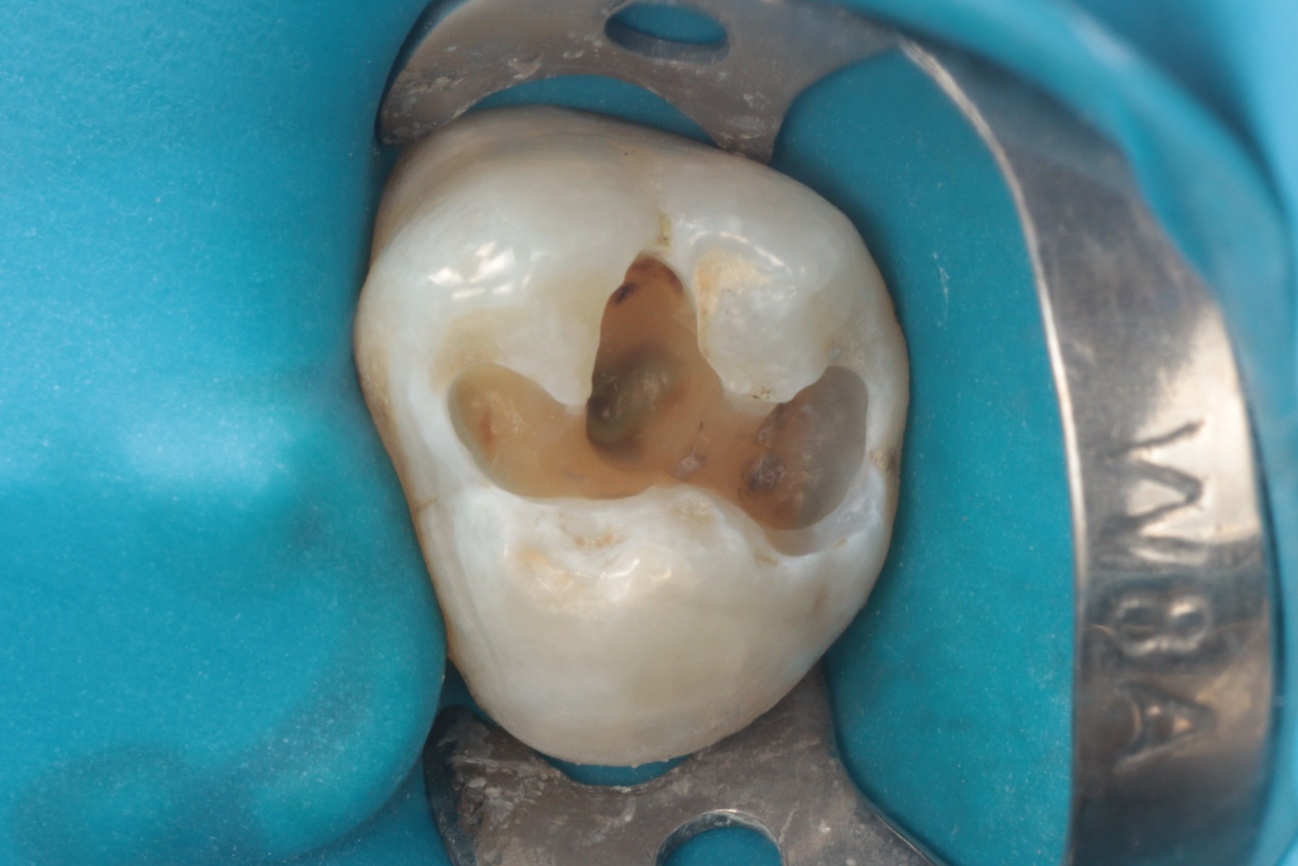 Figura 5 - Pós lavar e secar