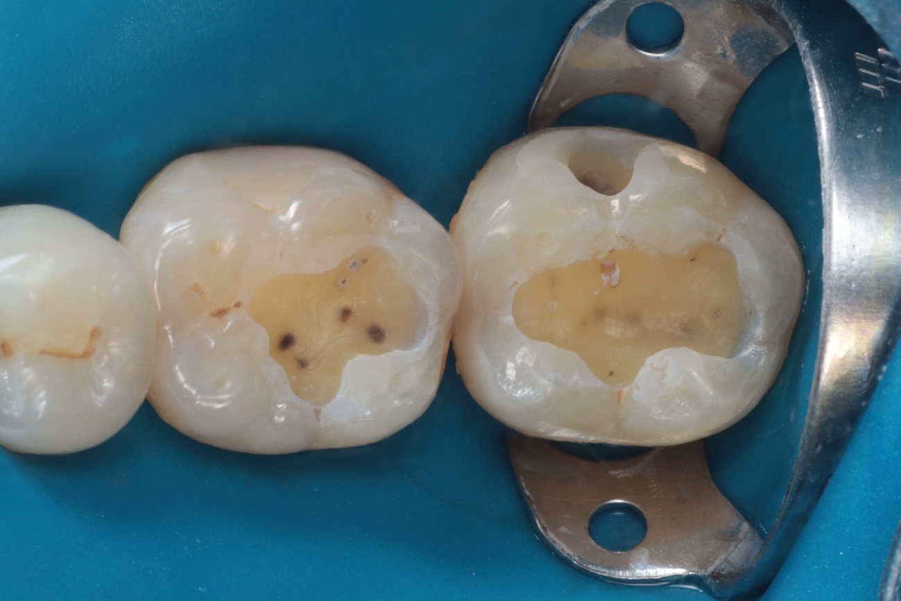 Figura 5 - Pós lavar e secar