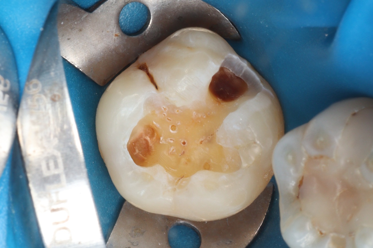 Figura 7 – pós lavar e secar