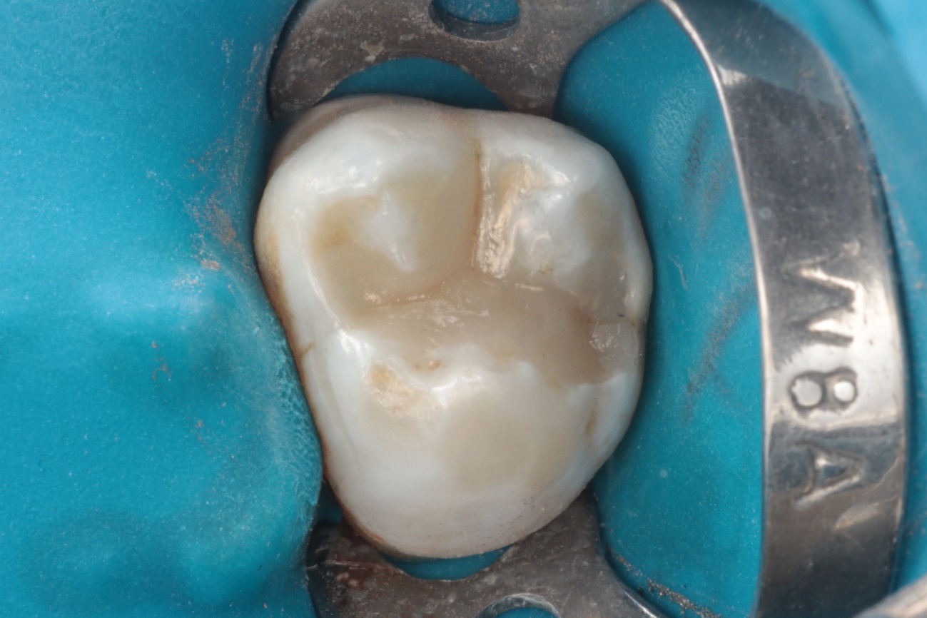 Figura 7 – Morfologia oclusal