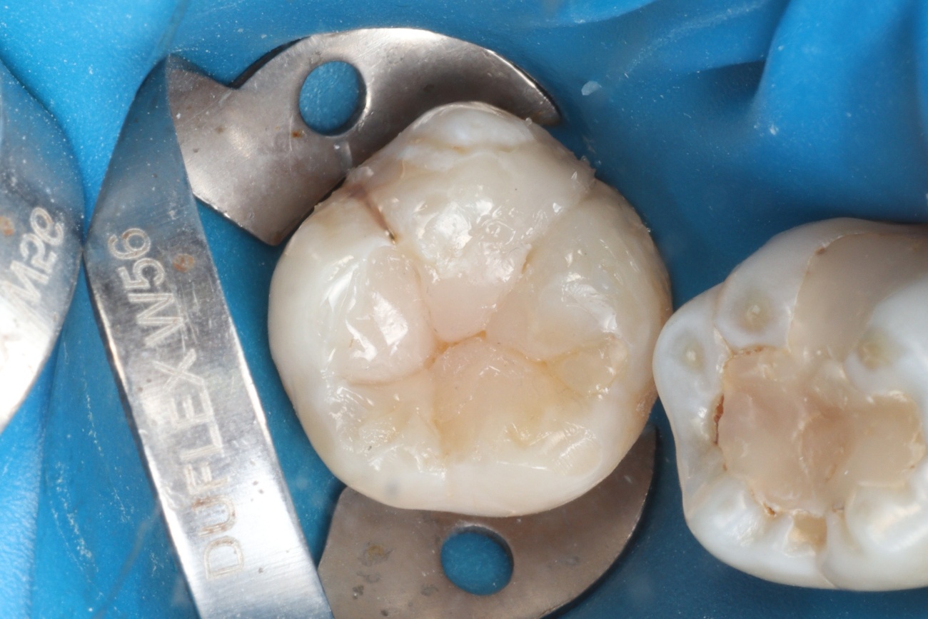 Figura 13 – morfologia oclusal