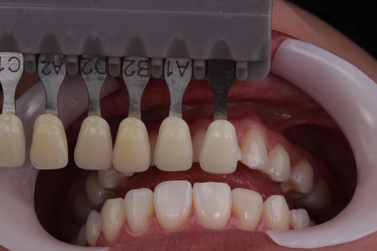 Figura 2- Registro de cor inicial