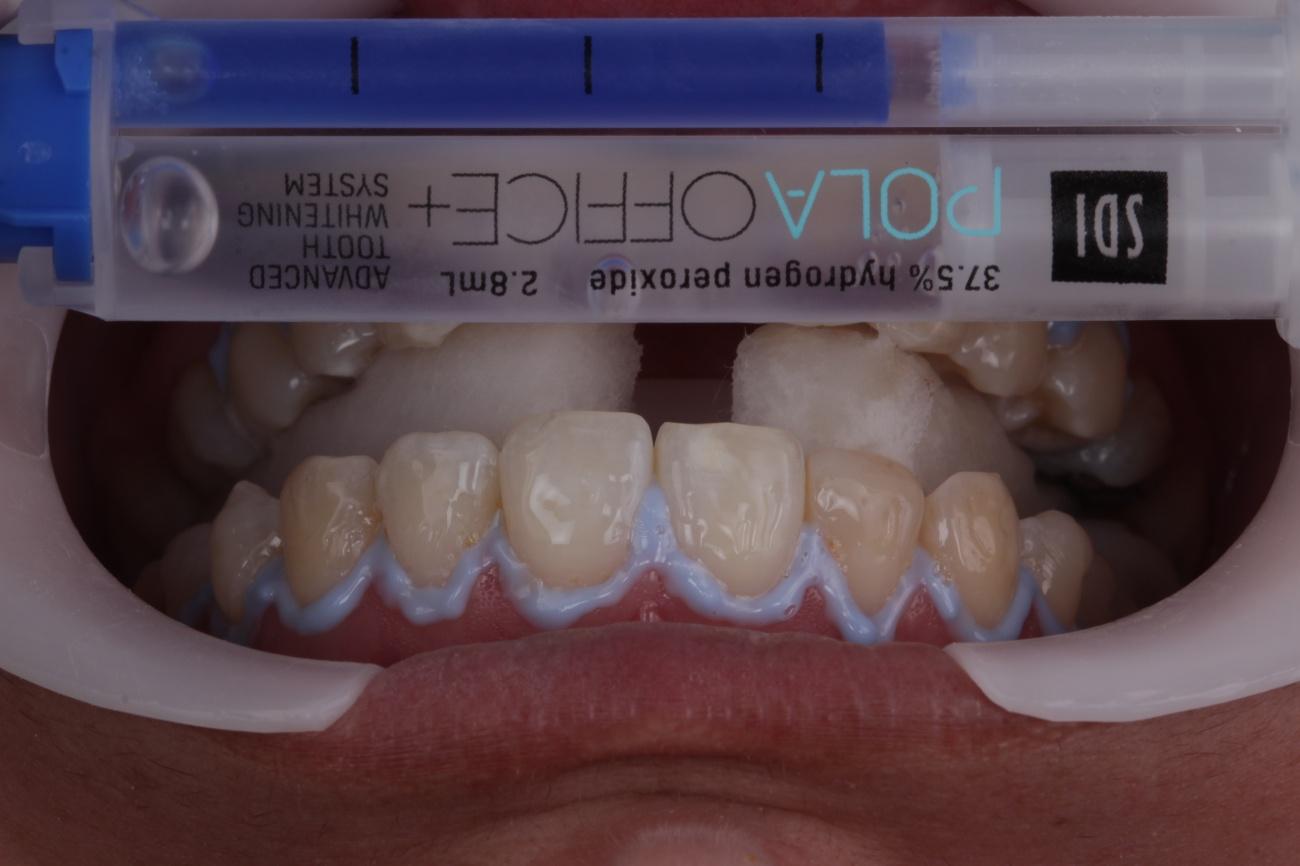 Figura 6 - Pola Office +