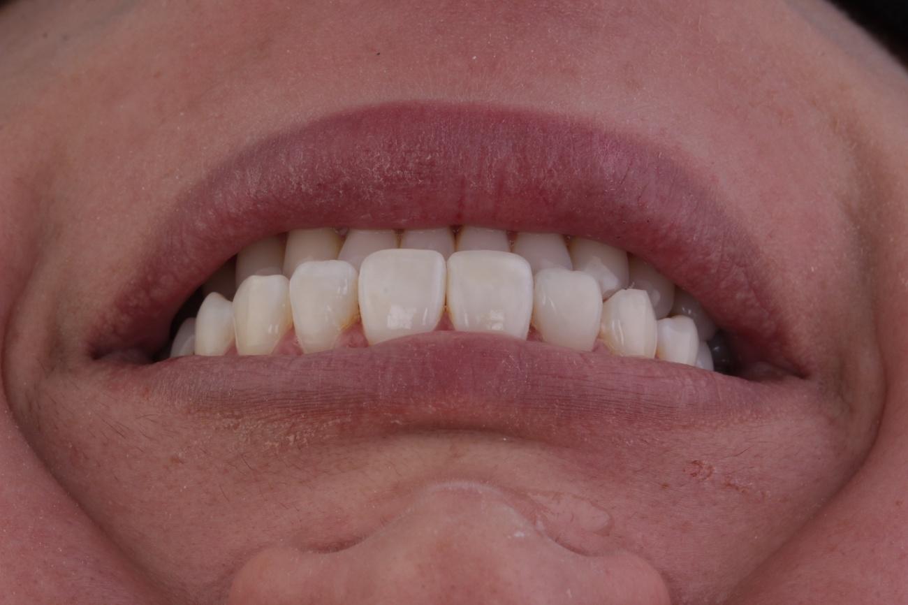 Figura 9 - Fotografia final 