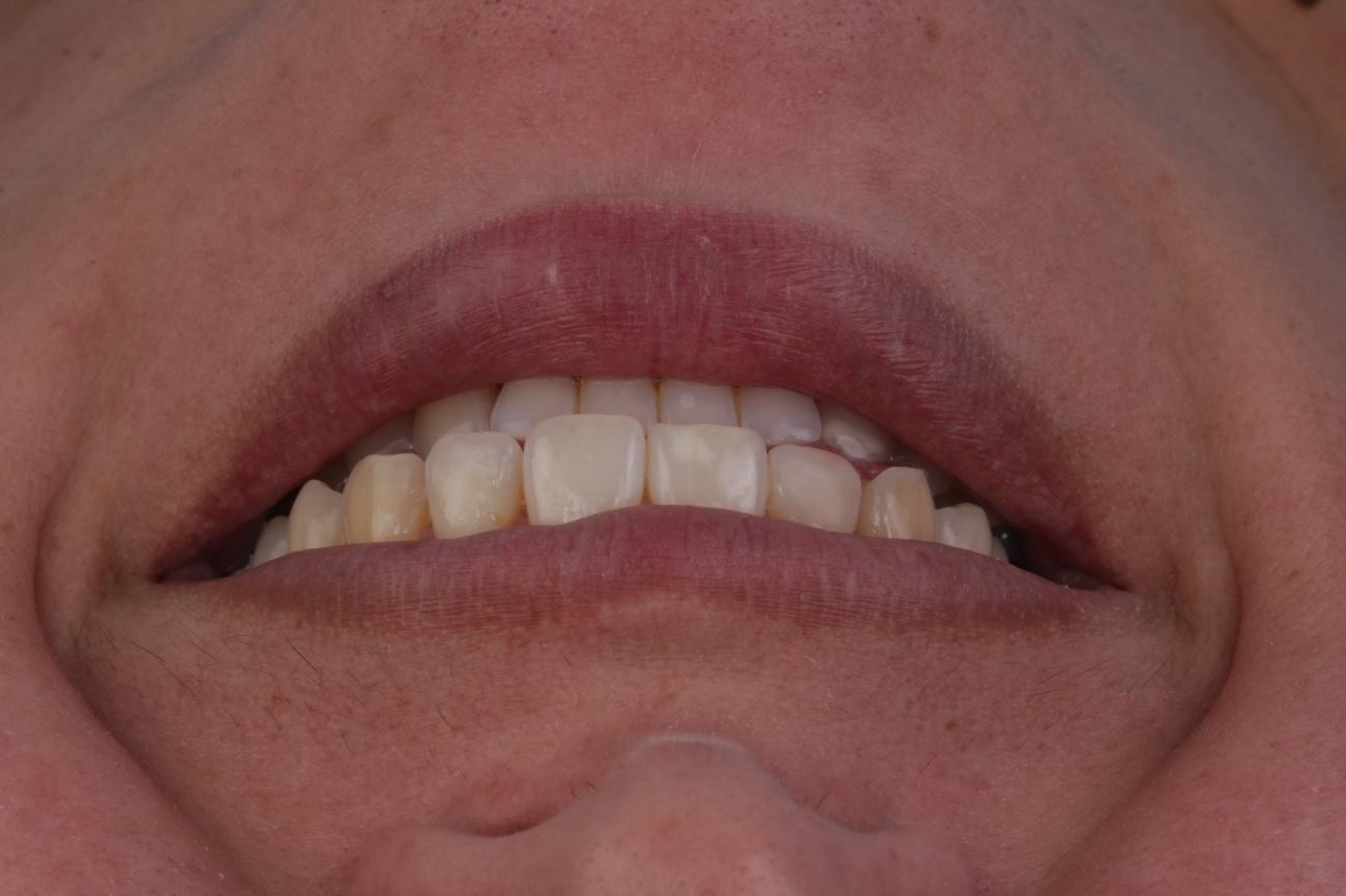 Figura 1 – Fotografia Inicial